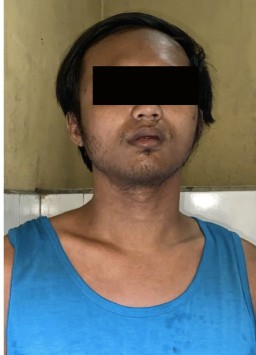 Polisi Amankan Pemuda Karang Tembok Curi Cincin Kawin dan Jam Tangan Lewat Jendela Rumah