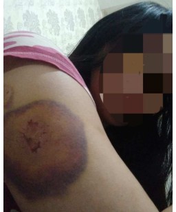 KDRT Terhadap Istri Siri, Anggota DPRD Sampang Dilaporkan ke Kepolisian