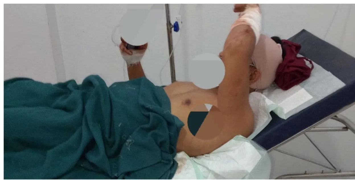 Pembacokan Wartawan di Tuban Harus Di Usut Tuntas. APH Segera Tangkap Oknum Preman