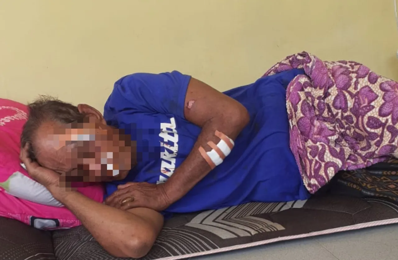 ‎Dituding Santet, Warga Camplong Jadi Korban Penganiayaan Brutal Tetangga Sendiri ‎