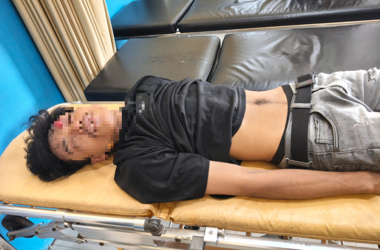 Terduga pelaku pencurian sepeda motor tengah menjalani perawatan di Puskesmas Torjun usai mengalami luka-luka.. akibat Kecelakaan/Bn.