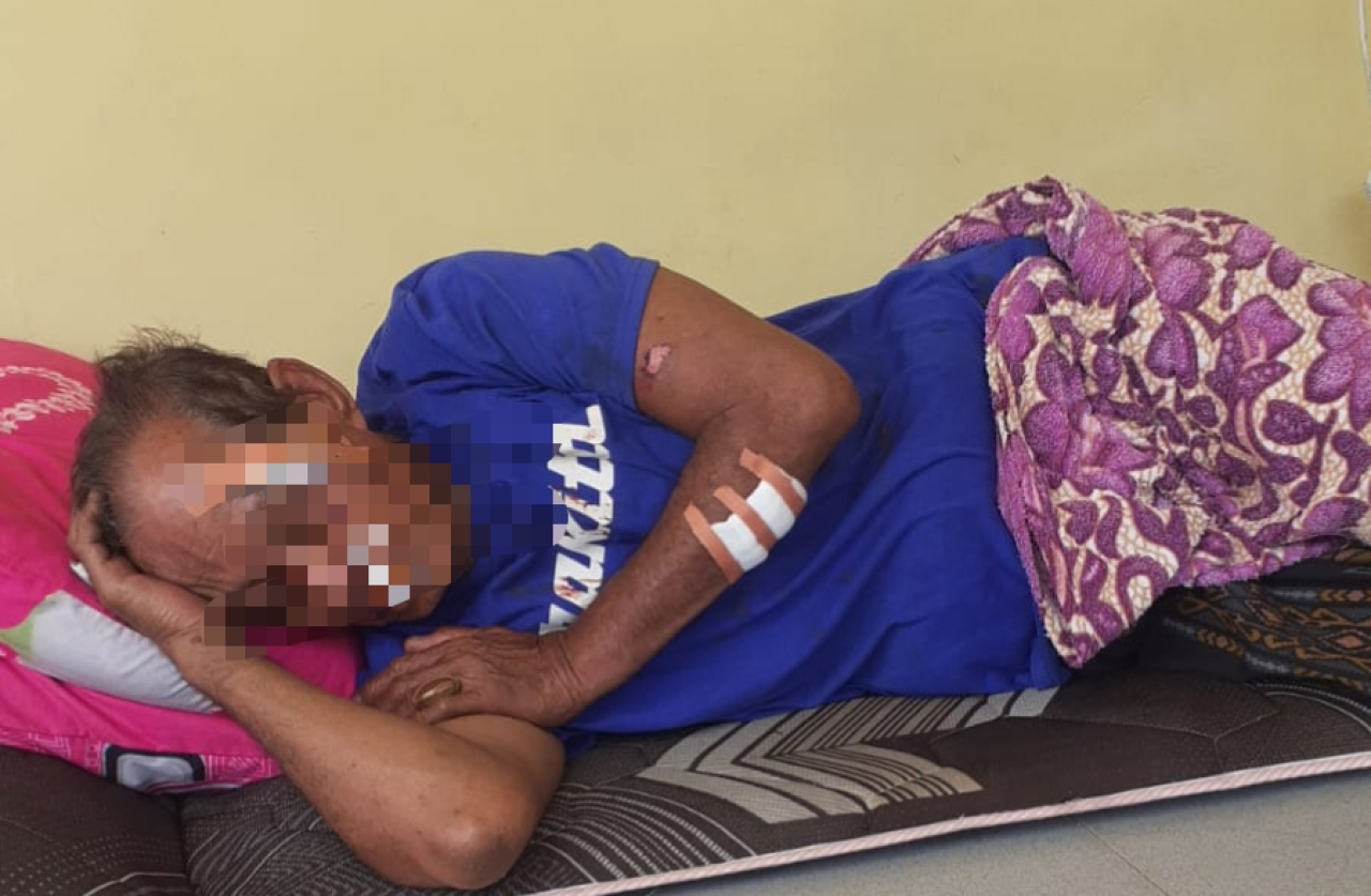 ‎Korban penganiayaan di Camplong terbaring lemah dengan luka di wajah dan tubuh, usai diduga dianiaya tetangganya sendiri/Istimewa/Bn.